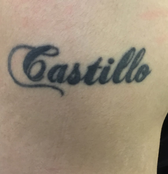 affordable laser tattoo removal in sydney evolution laser clinic affordable laser tattoo removal in sydney evolution laser clinic