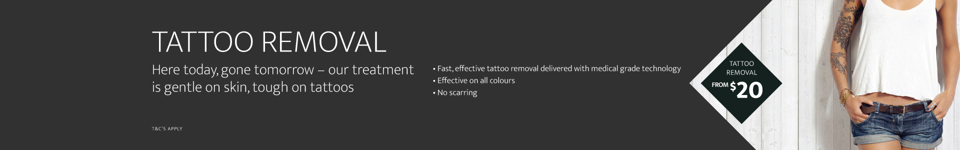 Affordable Laser Tattoo Removal in Sydney | Evolution ...