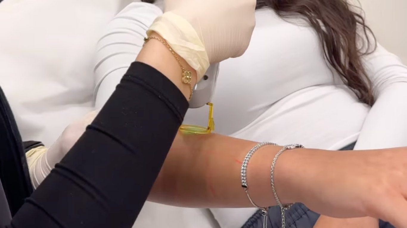 What to Expect During the Session