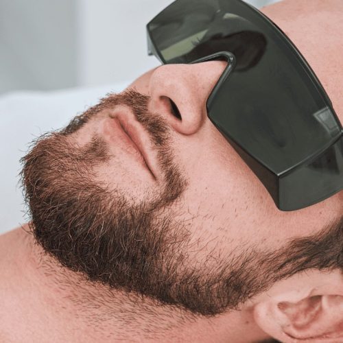 Laser Hair Removal for Men