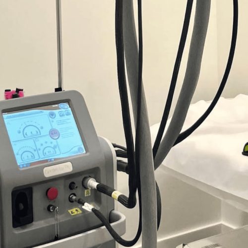 How Many Sessions Do You Really Need?