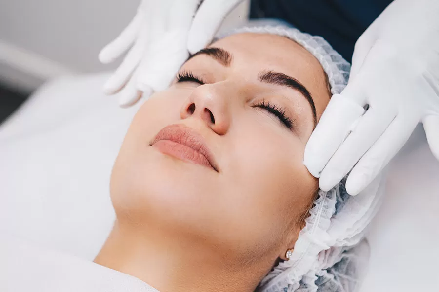 Skin Peels