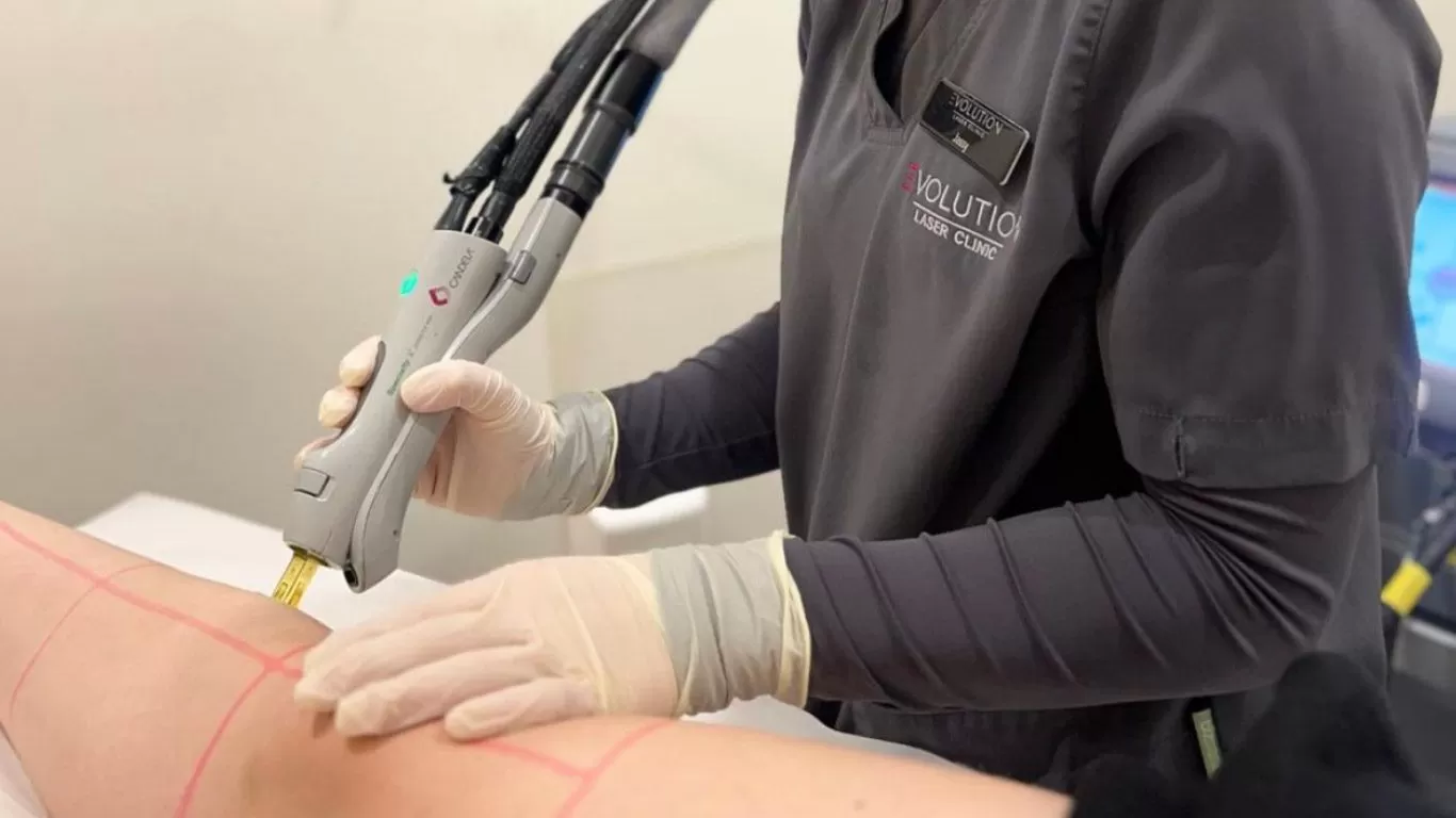 Understanding Laser Hair Removal