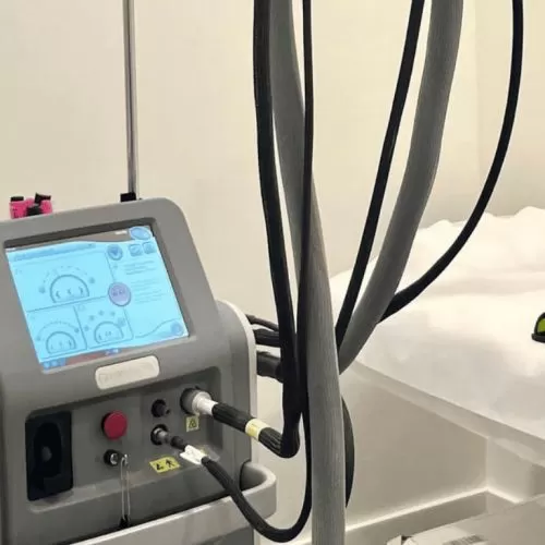 How Many Sessions Do You Really Need?